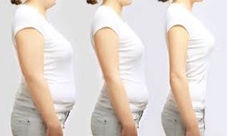 Slimming Surgeries 101: What You Need to Know in Dubai