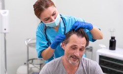 Revitalize Your Locks: FUE Hair Transplant in Turkey
