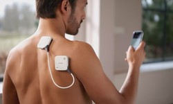 Tens Units for Anxiety: Can Electrical Stimulation Help Relieve Stress?