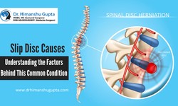 Spinal Fixation Causes: A Closer Look at Risk Factors and Solutions
