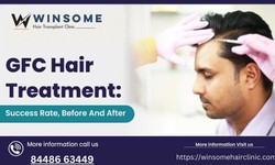 Gfc Hair Treatment Near Me In Noida Sector 18 — Winsome Hair Clinic