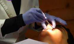 Get an Affordable and Painless Solution for Your Tooth Extraction Procedure