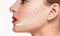 Unlocking Natural Beauty: The Art of PDO Facelift and Nose Thread Lift in Houston