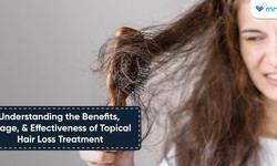 Understanding the Benefits, Usage, and Effectiveness of Topical Hair Loss Treatment