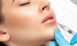 Enhancing Your Beauty: Lip Fillers in Islamabad