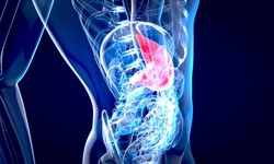 Navigating Pancreatic Cancer: A Detailed Overview
