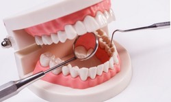 Filling in the Gaps: Understanding Teeth Fillings