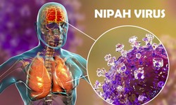 Nipah Virus Symptoms in Humans Don’t Ignore These Warning Signs