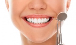 Brighten Your Smile: Teeth Whitening Options in Cardiff