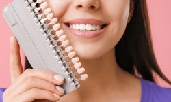 Why Dental Veneers Are the Perfect Solution for Crooked Teeth
