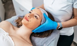 The Role of Aestheticians in Chemical Peel Treatments