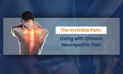 Naprosyn with Flexabenz ER: A Path to Relief from Neuropathic Pain