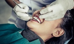 Filling in the Gaps: All About Teeth Fillings