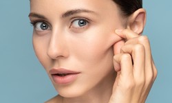 Benefits of Mid Facelift Surgery