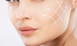 Dermal Fillers Injections in Dubai: Your Ticket to Timeless Beauty