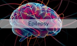 Epilepsy Revealed: Dispelling Myths and Telling Tales