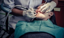 Painless Wisdom Teeth Extraction: Your Guide to Nearby Removal Services
