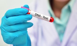 Personalized Wellness: DNA Nutrition Tests Available in Dubai