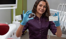 Top 5 Factors to Consider When Selecting an Invisalign Treatment