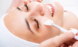 The Perfect Peel: Experience Chemical Peels in Dubai Today!