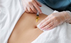 The Lowdown on Fat Dissolving Injections: Are They Worth It?