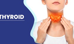 Expert Homeopathic Remedies for Women's Thyroid Health by Dr. Tushar Mishra