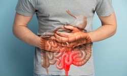 8 Effective Tips to Avoid Gastric Issues: Your Roadmap to Digestive Wellness