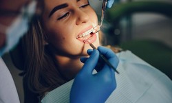 Straight Talk: Navigating the World of Orthodontics