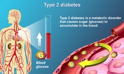 Understanding Type 2 Diabetes Blood Sugar Levels