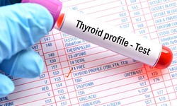 Unlocking the Mystery of Thyroid Health: The Importance of Thyroid Testing