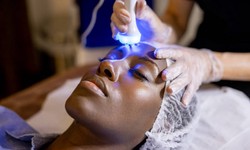 Unlocking the Beauty Secrets: The Power of Laser Med Spa