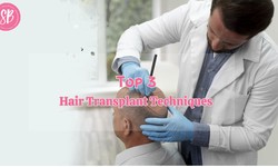 Top 3 Hair Transplant Techniques