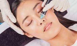 Hydrafacial Treatment: Experience the Difference for Yourself edit