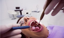 Saving Smiles: The Essentials of Root Canal in Medford