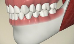 What comes under emergency dental care in Calgary?