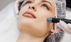 The Microneedling Miracle: Transforming Your Skin from Within
