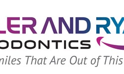 Why Must You Choose Invisalign Clear Aligners in Richmond