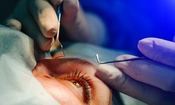 The Advancements in Cataract Surgery is for Better Vision