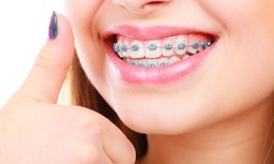 The Ultimate Guide to Choosing the Right Orthodontist for Your Smile Makeover
