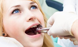 Know About The Wisdom Teeth & Possible Treatment