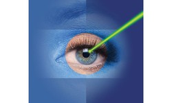 Explore the long-term outcomes for individuals who have undergone laser eye surgery.