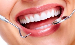 Mouthguards 101: Everything You Need to Know to Keep Your Teeth Intact