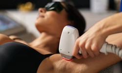 Underarm Hair Removal: Achieve Smooth Armpit Effortlessly