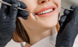 Teeth Whitening Penrith