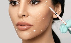 How Do Under Eye Filler Injections Compare to Topical Treatments for Dark Circles?