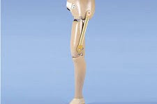 artificial limb center in Gurgaon