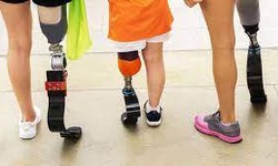 artificial limbs