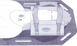 Management of Injuries to the Skull, Spinal Column, and Chest