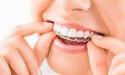 Invisalign - The Treatment Process