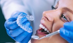 Achieving a Perfect Smile with Invisible Braces